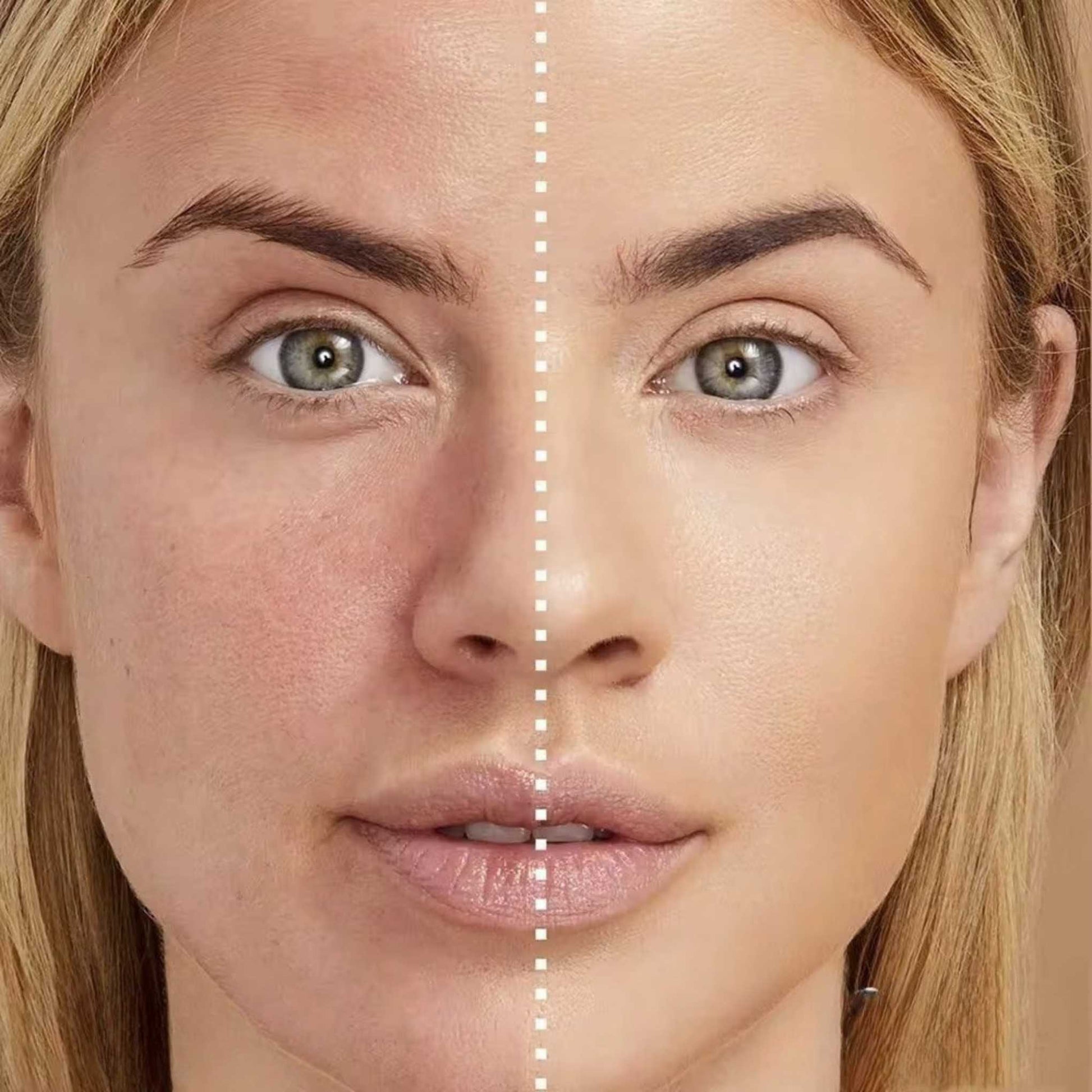 Before and after effect of Oplenza Natural Finish Cream Concealer on a model face