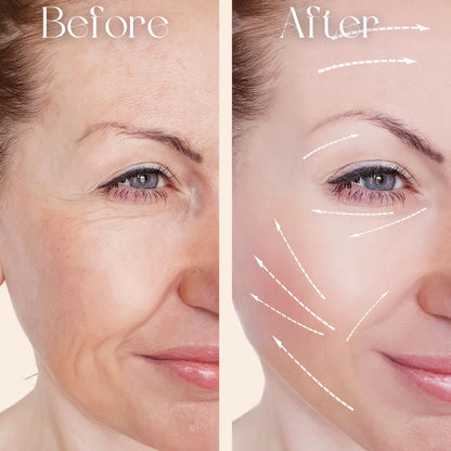 Before and after comparison of Oplenza face and neck massager device, best handheld facial massager device