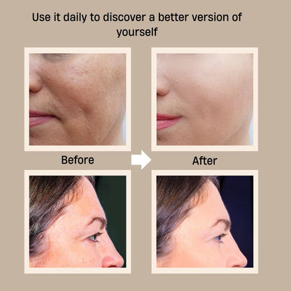 Before and after skincare results from Oplenza skincare wand - Soft Taupe, White 